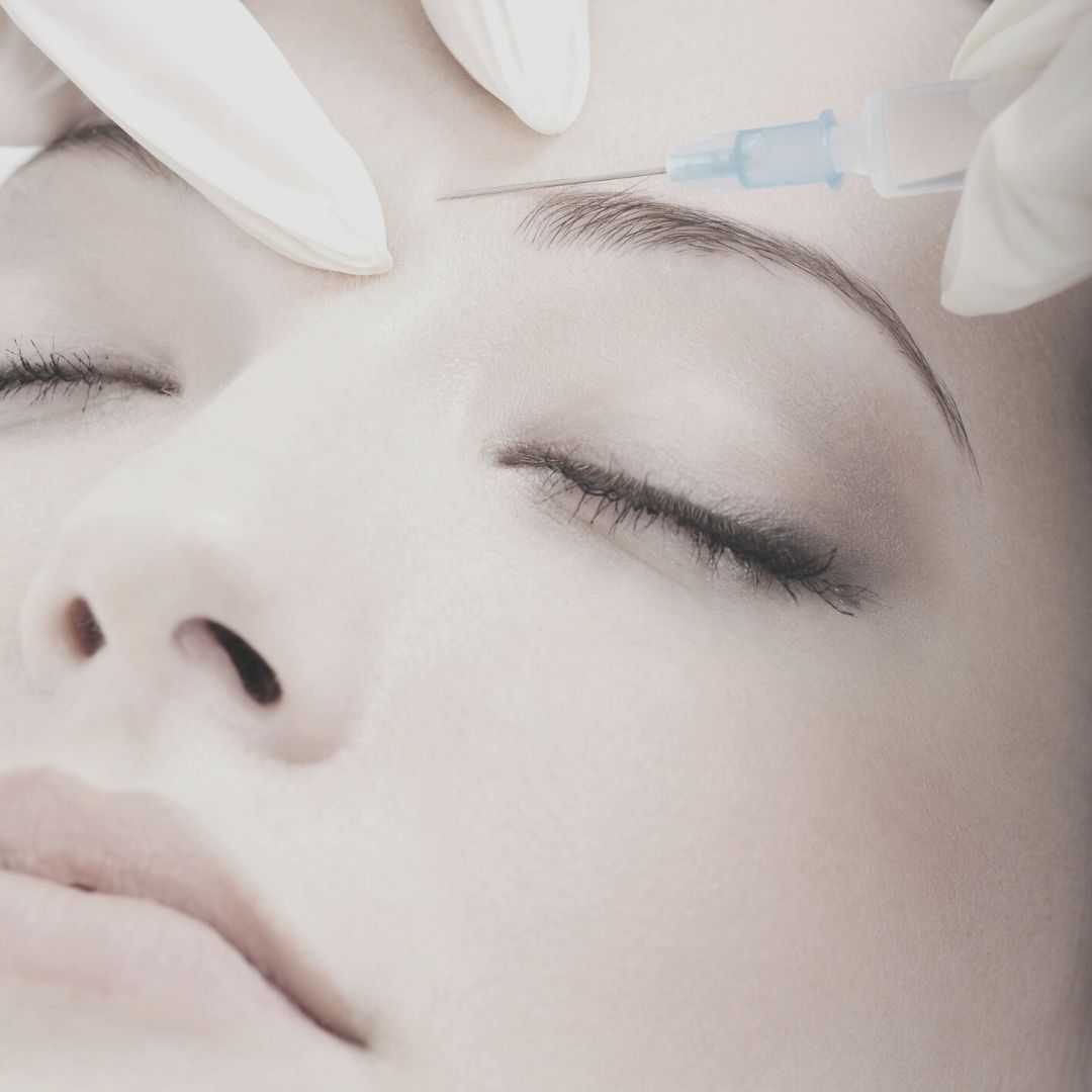 Botox Treatment