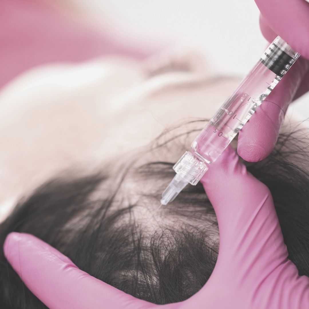 Hair Restoration