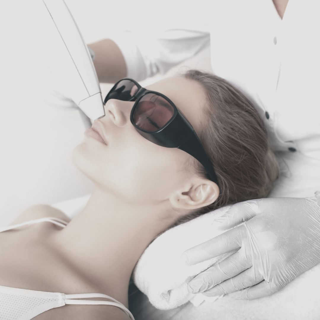IPL Treatment
