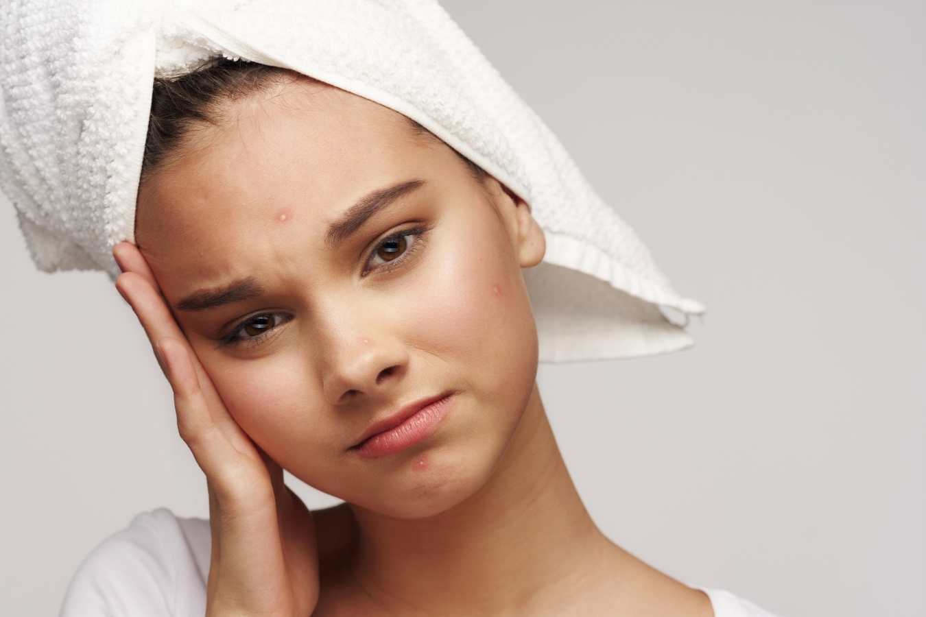 Acne Care