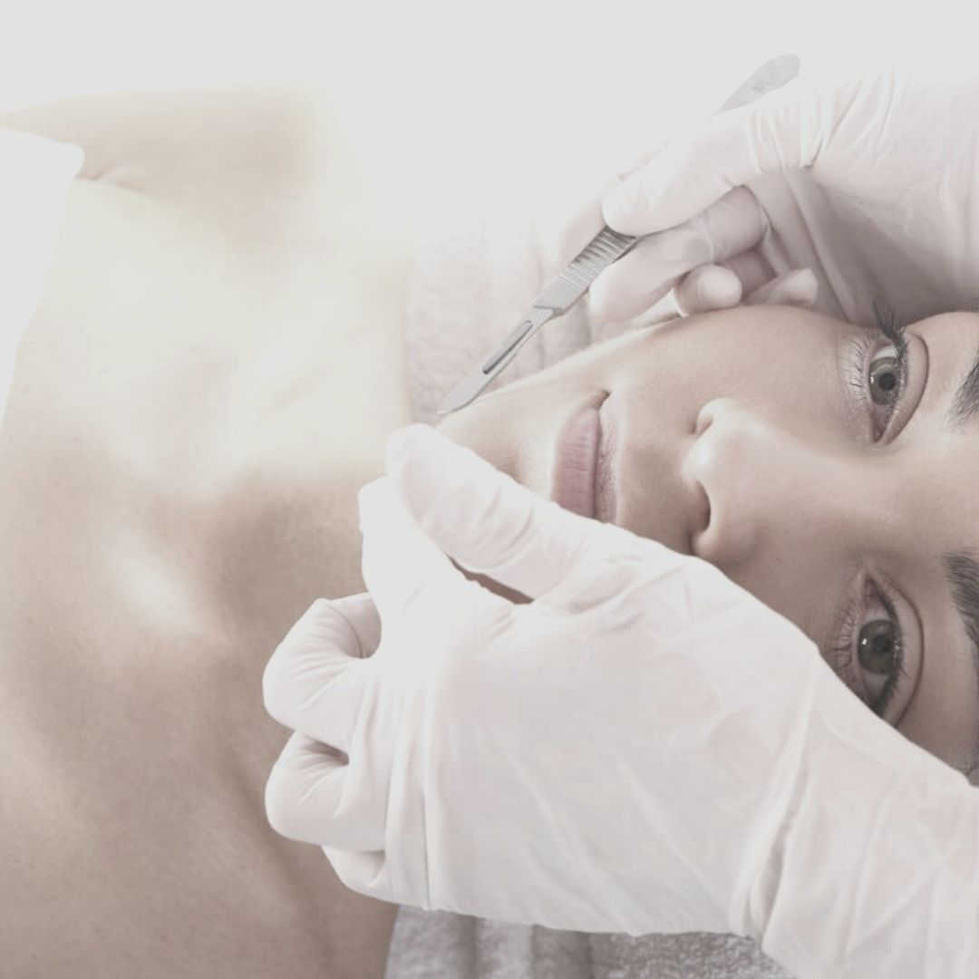 Dermaplaning